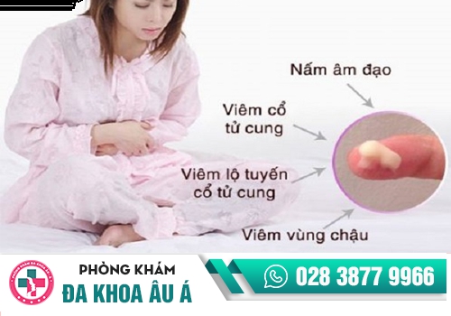 5 BỆNH PHỤ KHOA MÀ NỮ GIỚI HAY MẮC PHẢI